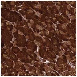 MED19 Rabbit anti-Human, Polyclonal Antibody, Abnova 100&mu;L; Unlabeled:Antibodies,