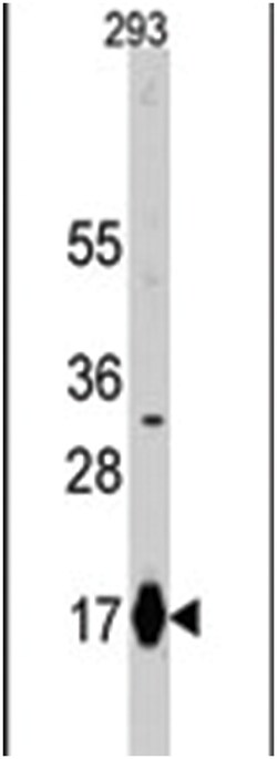 IFITM3 Rabbit anti-Human, Polyclonal Antibody, Abnova 400 &mu;L | Buy Online | Abnova Corporation | Fisher Scientific