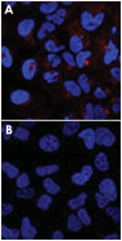 IFITM3 Rabbit anti-Human, Polyclonal Antibody, Abnova 400 &mu;L | Buy Online | Abnova Corporation | Fisher Scientific