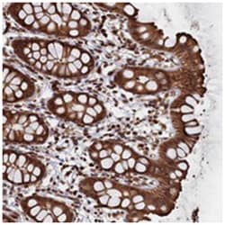 PIGN Rabbit anti-Human, Polyclonal Antibody, Abnova 100 &mu;L | Buy Online | Abnova Corporation | Fisher Scientific