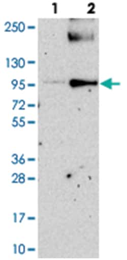 PIGN Rabbit anti-Human, Polyclonal Antibody, Abnova 100 &mu;L | Buy Online | Abnova Corporation | Fisher Scientific