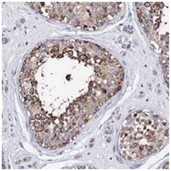 ATP8A2, Rabbit, Polyclonal Antibody, Abnova 100 &mu;L | Buy Online | Abnova Corporation | Fisher Scientific