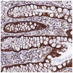 AP4S1, Rabbit, Polyclonal Antibody, Abnova 100 &mu;L | Buy Online | Abnova Corporation | Fisher Scientific