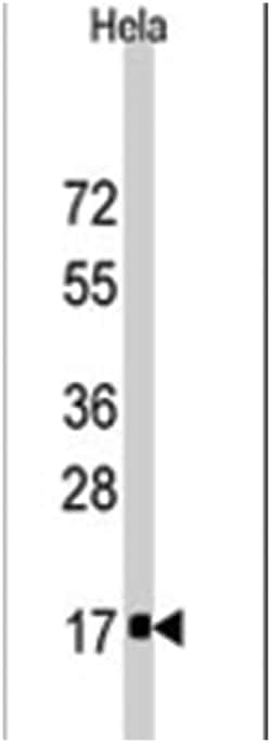 IFITM3 Rabbit anti-Human, Polyclonal Antibody, Abnova 400 &mu;L | Buy Online | Abnova Corporation | Fisher Scientific