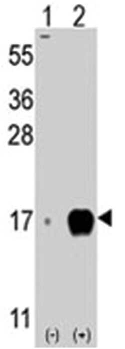 IFITM3 Rabbit anti-Human, Polyclonal Antibody, Abnova 400 &mu;L | Buy Online | Abnova Corporation | Fisher Scientific