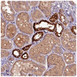 TIGD3, Rabbit, Polyclonal Antibody, Abnova 100 &mu;L | Buy Online | Abnova Corporation | Fisher Scientific