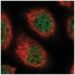 C11orf49 Rabbit anti-Human, Polyclonal Antibody, Abnova 100 &mu;L | Buy Online | Abnova Corporation | Fisher Scientific