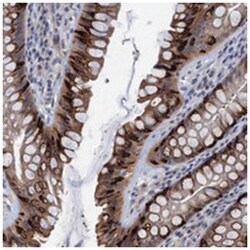 CKAP2L Rabbit anti-Human, Polyclonal Antibody, Abnova 100 &mu;L | Buy Online | Abnova Corporation | Fisher Scientific