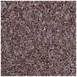 CHCHD8, Rabbit, Polyclonal Antibody, Abnova 100&mu;L; Unlabeled:Antibodies,