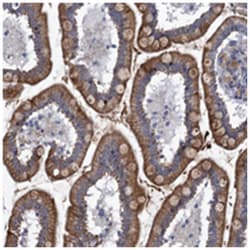 FAM214A Rabbit anti-Human, Polyclonal Antibody, Abnova 100 &mu;L | Buy Online | Abnova Corporation | Fisher Scientific