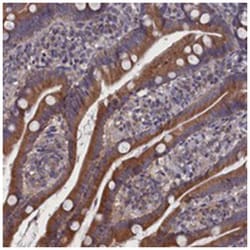 SPATA13 Rabbit anti-Human, Polyclonal Antibody, Abnova 100 &mu;L | Buy Online | Abnova Corporation | Fisher Scientific