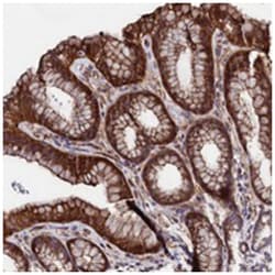 STAMBPL1, Rabbit, Polyclonal Antibody, Abnova 100 &mu;L | Buy Online | Abnova Corporation | Fisher Scientific