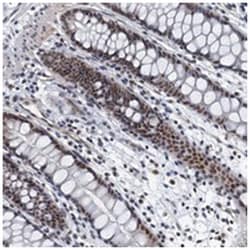 GADL1 Rabbit anti-Human, Polyclonal Antibody, Abnova 100 &mu;L | Buy Online | Abnova Corporation | Fisher Scientific