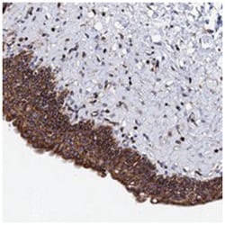 ZDHHC18, Rabbit, Polyclonal Antibody, Abnova 100 &mu;L | Buy Online | Abnova Corporation | Fisher Scientific