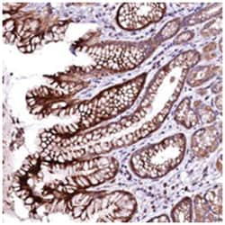 OVCH1, Rabbit, Polyclonal Antibody, Abnova 100 &mu;L | Buy Online | Abnova Corporation | Fisher Scientific