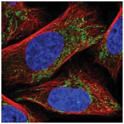 CLPX, Rabbit, Polyclonal Antibody, Abnova 100 &mu;L | Buy Online | Abnova Corporation | Fisher Scientific