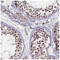 C11orf49 Rabbit anti-Human, Polyclonal Antibody, Abnova 100 &mu;L | Buy Online | Abnova Corporation | Fisher Scientific