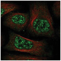 C11orf49 Rabbit anti-Human, Polyclonal Antibody, Abnova 100 &mu;L | Buy Online | Abnova Corporation | Fisher Scientific