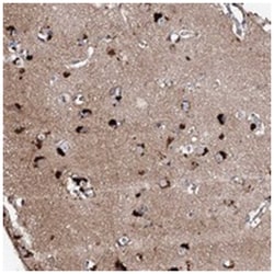 CKAP5 Rabbit anti-Human, Polyclonal Antibody, Abnova 100 &mu;L | Buy Online | Abnova Corporation | Fisher Scientific