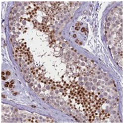 C15orf55, Rabbit, Polyclonal Antibody, Abnova 100 &mu;L | Buy Online | Abnova Corporation | Fisher Scientific