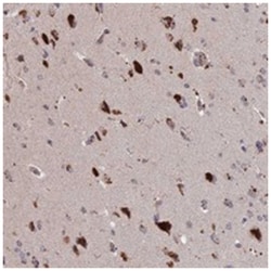 ADO Rabbit anti-Human, Polyclonal Antibody, Abnova 100 &mu;L | Buy Online | Abnova Corporation | Fisher Scientific