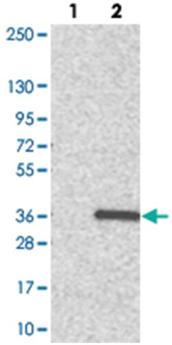 ADO Rabbit anti-Human, Polyclonal Antibody, Abnova 100 &mu;L | Buy Online | Abnova Corporation | Fisher Scientific