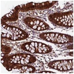 CCDC15 Rabbit anti-Human, Polyclonal Antibody, Abnova 100 &mu;L | Buy Online | Abnova Corporation | Fisher Scientific
