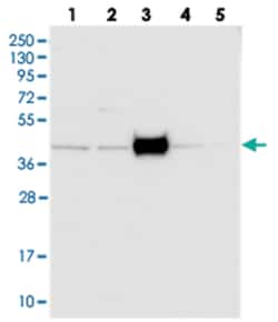 FAM154B Rabbit anti-Human, Polyclonal Antibody, Abnova 100 &mu;L | Buy Online | Abnova Corporation | Fisher Scientific