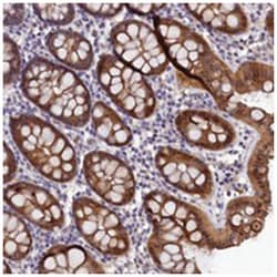 FAM154B Rabbit anti-Human, Polyclonal Antibody, Abnova 100 &mu;L | Buy Online | Abnova Corporation | Fisher Scientific