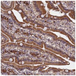 SLC16A14 Rabbit anti-Human, Polyclonal Antibody, Abnova 100&mu;L; Unlabeled:Antibodies,