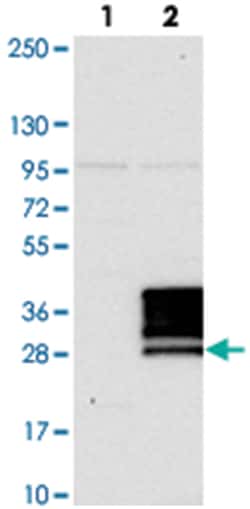 NRIP3, Rabbit, Polyclonal Antibody, Abnova 100&mu;L; Unlabeled:Antibodies,