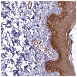 FOPNL, Rabbit, Polyclonal Antibody, Abnova 100&mu;L; Unlabeled:Antibodies,