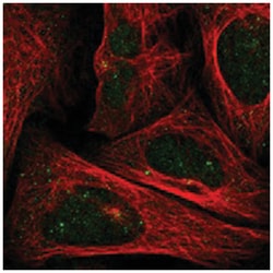 FOPNL, Rabbit, Polyclonal Antibody, Abnova 100&mu;L; Unlabeled:Antibodies,