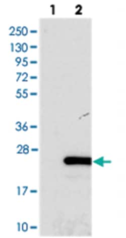 FOPNL, Rabbit, Polyclonal Antibody, Abnova 100&mu;L; Unlabeled:Antibodies,