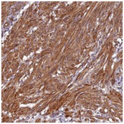 CCDC102B, Rabbit, Polyclonal Antibody, Abnova 100&mu;L; Unlabeled:Antibodies,