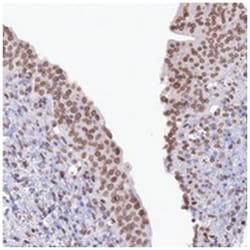 TMPRSS7, Rabbit, Polyclonal Antibody, Abnova 100 &mu;L | Buy Online | Abnova Corporation | Fisher Scientific