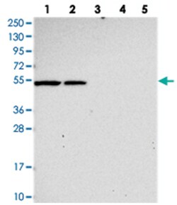 SLC24A6, Rabbit, Polyclonal Antibody, Abnova 100&mu;L; Unlabeled:Antibodies,