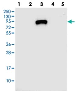 IGFALS Rabbit anti-Human, Polyclonal Antibody, Abnova 100 &mu;L | Buy Online | Abnova Corporation | Fisher Scientific