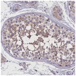 IGFALS Rabbit anti-Human, Polyclonal Antibody, Abnova 100 &mu;L | Buy Online | Abnova Corporation | Fisher Scientific