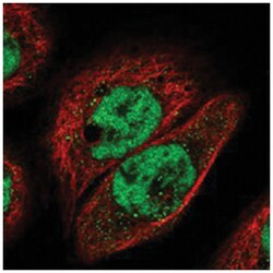 IGFALS Rabbit anti-Human, Polyclonal Antibody, Abnova 100 &mu;L | Buy Online | Abnova Corporation | Fisher Scientific