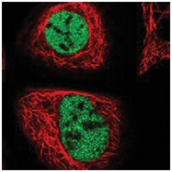 ZMIZ2 Rabbit anti-Human, Polyclonal Antibody, Abnova 100&mu;L; Unlabeled:Antibodies,