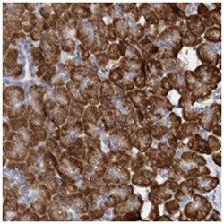 DNAJC21, Rabbit, Polyclonal Antibody, Abnova 100&mu;L; Unlabeled:Antibodies,