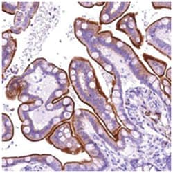 ANKRD32, Rabbit, Polyclonal Antibody, Abnova 100 &mu;L | Buy Online | Abnova Corporation | Fisher Scientific