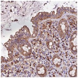 METTL22, Rabbit, Polyclonal Antibody, Abnova 100&mu;L; Unlabeled:Antibodies,