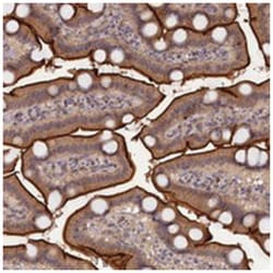 TMC5 Rabbit anti-Human, Polyclonal Antibody, Abnova 100 &mu;L | Buy Online | Abnova Corporation | Fisher Scientific