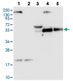 SYT17, Rabbit, Polyclonal Antibody, Abnova 100 &mu;L | Buy Online | Abnova Corporation | Fisher Scientific