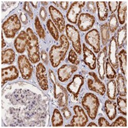 SYT17, Rabbit, Polyclonal Antibody, Abnova 100 &mu;L | Buy Online | Abnova Corporation | Fisher Scientific