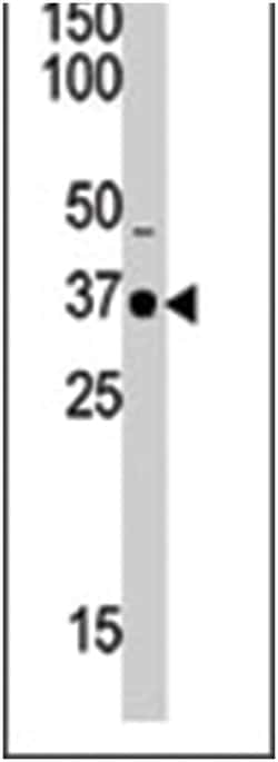 SETD7 Rabbit anti-Human, Polyclonal Antibody, Abnova 400 &mu;L | Buy Online | Abnova Corporation | Fisher Scientific