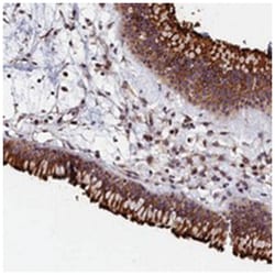 GRXCR1, Rabbit, Polyclonal Antibody, Abnova 100 &mu;L | Buy Online | Abnova Corporation | Fisher Scientific