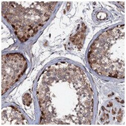 N4BP1 Rabbit anti-Human, Polyclonal Antibody, Abnova 100&mu;L; Unlabeled:Antibodies,